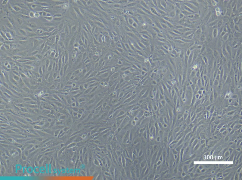 Human Endometrial Epithelial Cell Complete Medium - 3