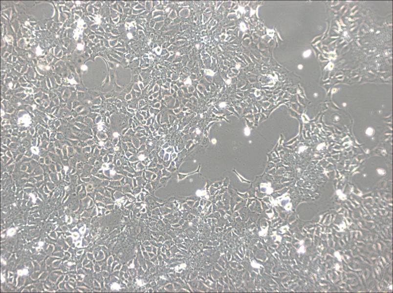 KYSE-140 Cell Complete MediumKYSE-140 Cell Complete Medium - 2