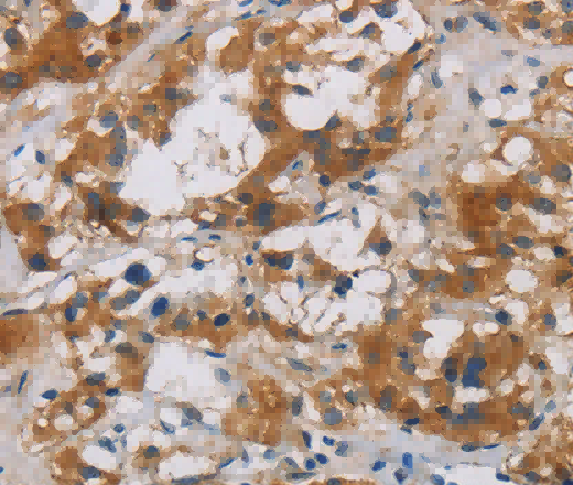 CNDP1 Polyclonal Antibody - 3