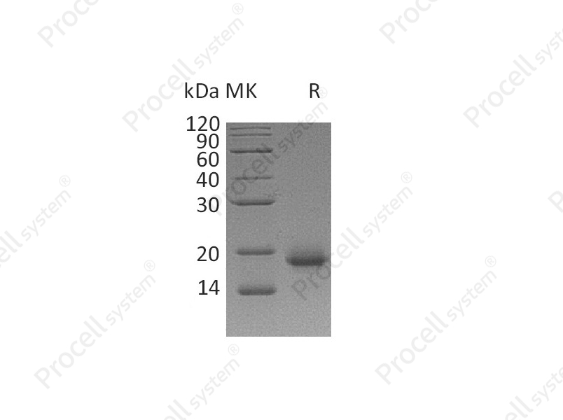 IL-4/BSF-1 (Cells), Human, Recombinant