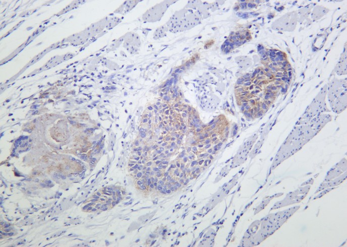 Recombinant ATG3 Monoclonal Antibody - small - 2