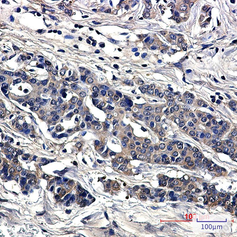 Recombinant SOD1/Superoxide Dismutase Monoclonal Antibody - 2