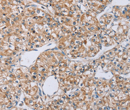EDA Polyclonal Antibody - 2