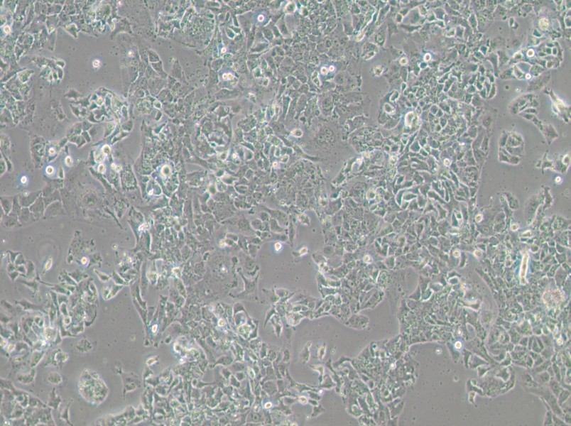 OV-90 Cell Complete MediumOV-90 Cell Complete Medium - 3