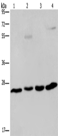 Western Blot analysis of A549 cell and Human hepatocellular carcinoma, Mouse liver tissue and HT-29 cell using ETHE1 Polyclonal Antibody at dilution of 1:400