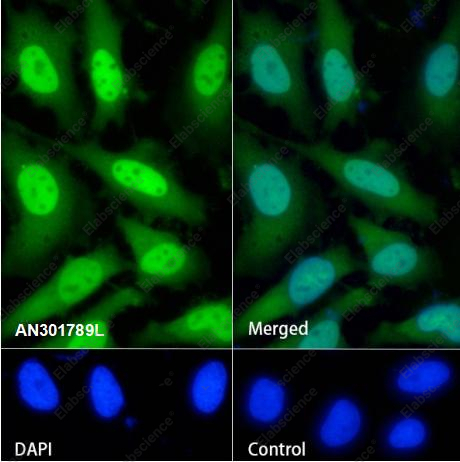 Recombinant RBX1 Monoclonal Antibody - 2