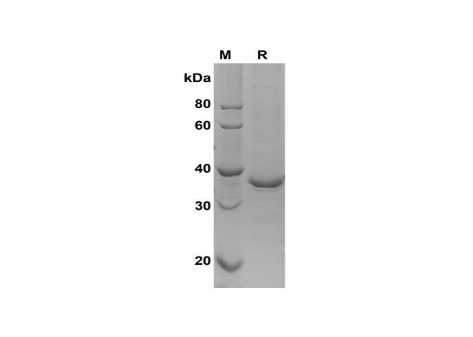 Recombinant Mouse IL-17A Protein(Halo Tag)-产品推荐-1
