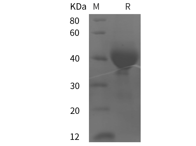 Recombinant Human CD38/SCARB3 Protein(His Tag)-产品推荐-1