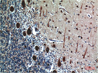 Immunohistochemistry of paraffin-embedded Human brain tissue using CST3 Monoclonal Antibody at dilution of 1:200.