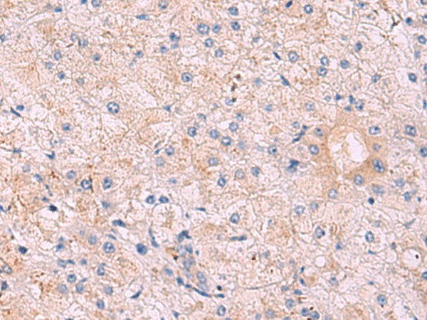 Immunohistochemistry of paraffin-embedded Human tonsil tissue  using KANSL1L Polyclonal Antibody at dilution of 1:40(?200)