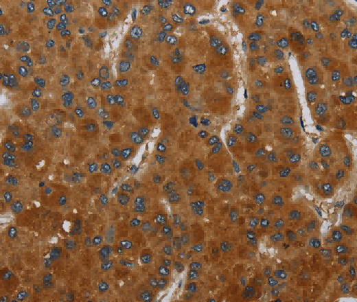 CSH1 Polyclonal Antibody - 2