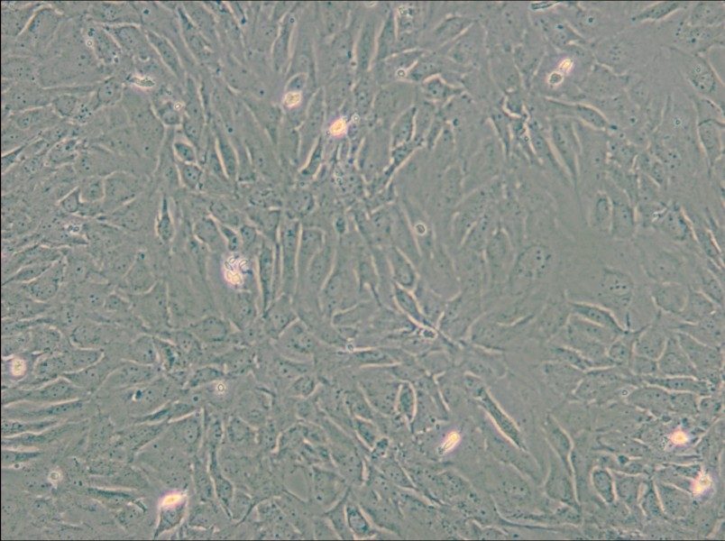 SW 982 [SW-982, SW982] (L15) Cell Complete Medium - small - 6