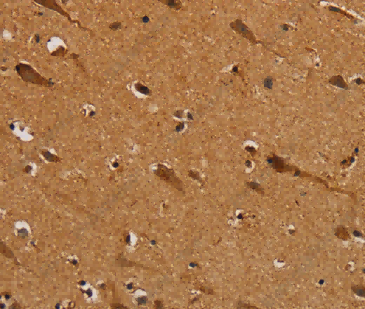 NDUFS5 Polyclonal Antibody - 3