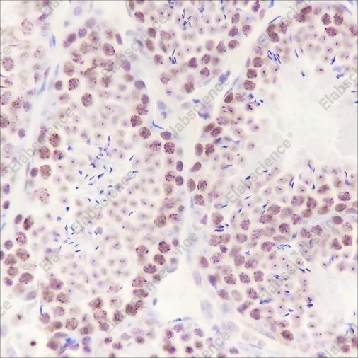 Recombinant HMGA1 Monoclonal Antibody - 1