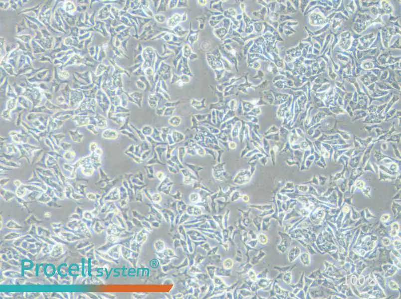 VCaP Cell Complete Medium - 1
