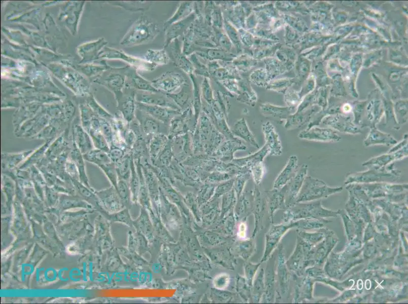 NCI-H647 Cell Complete Medium - 4