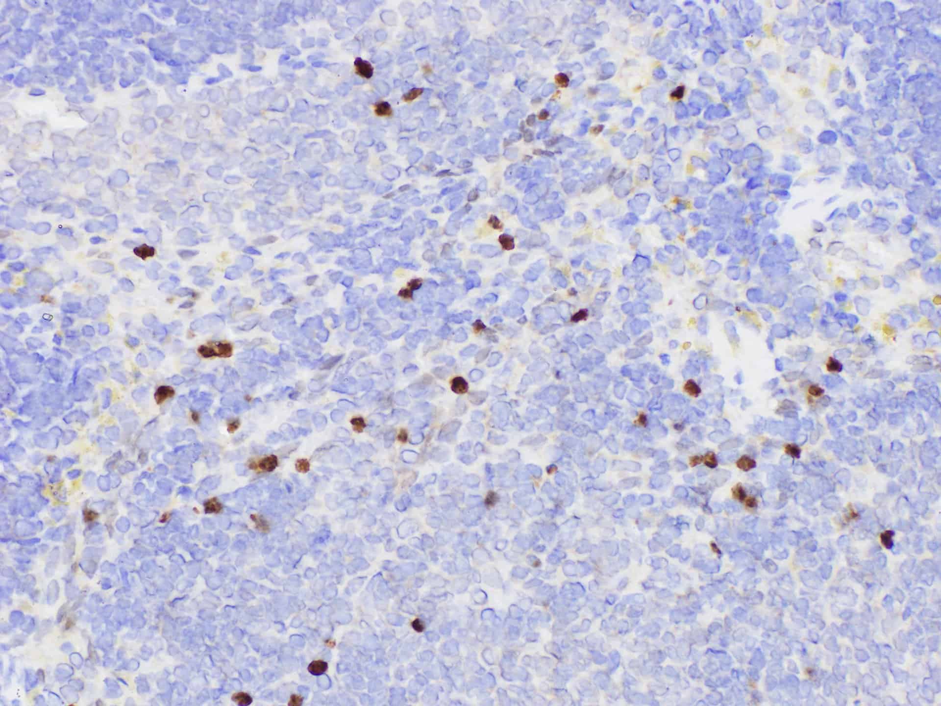 Purified Anti-Human TCRVβ7.1 Antibody[ZOE5.1]-产品推荐-1