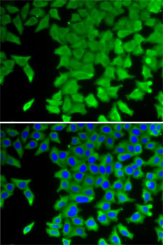 Immunofluorescence analysis of U2OS cells using CRABP2 Polyclonal Antibody Blue: DAPI for nuclear staining.