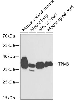 Western blot analysis of extracts of various cell lines using TPM3 Polyclonal Antibody at 1:1000 dilution.