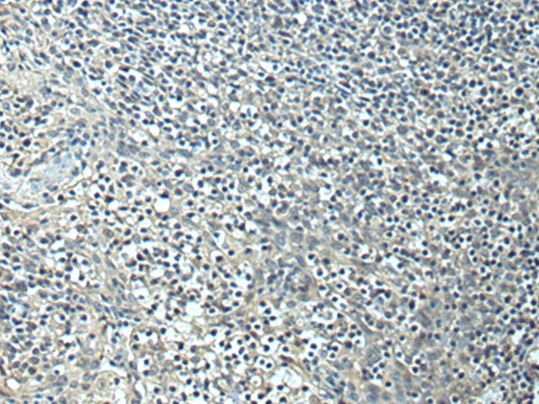 Immunohistochemistry of paraffin-embedded Human tonsil tissue  using SLC35F6 Polyclonal Antibody at dilution of 1:95(?200)