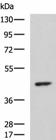 Western blot analysis of Hela cell lysate  using ARPC1B Polyclonal Antibody at dilution of 1:1000