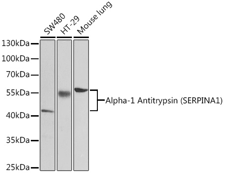 Western blot analysis of extracts of various cell lines using Alpha-1 Antitrypsin (Alpha-1 Antitrypsin (SERPINA1)) Polyclonal Antibody at 1:1000 dilution.