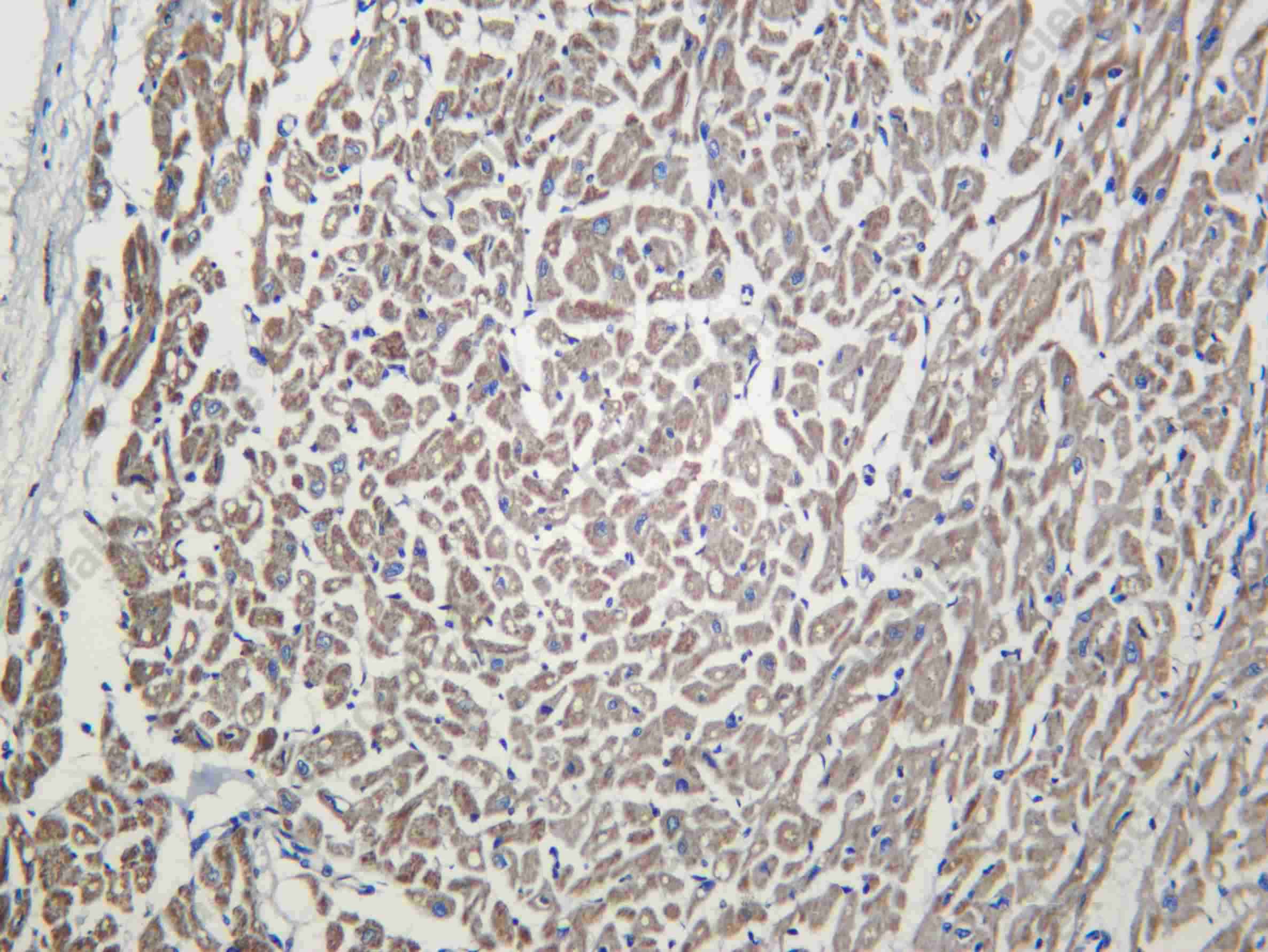 Recombinant SFRP4 Monoclonal Antibody - 1