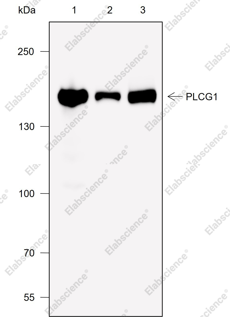 Recombinant PLCG1 Monoclonal Antibody - 1