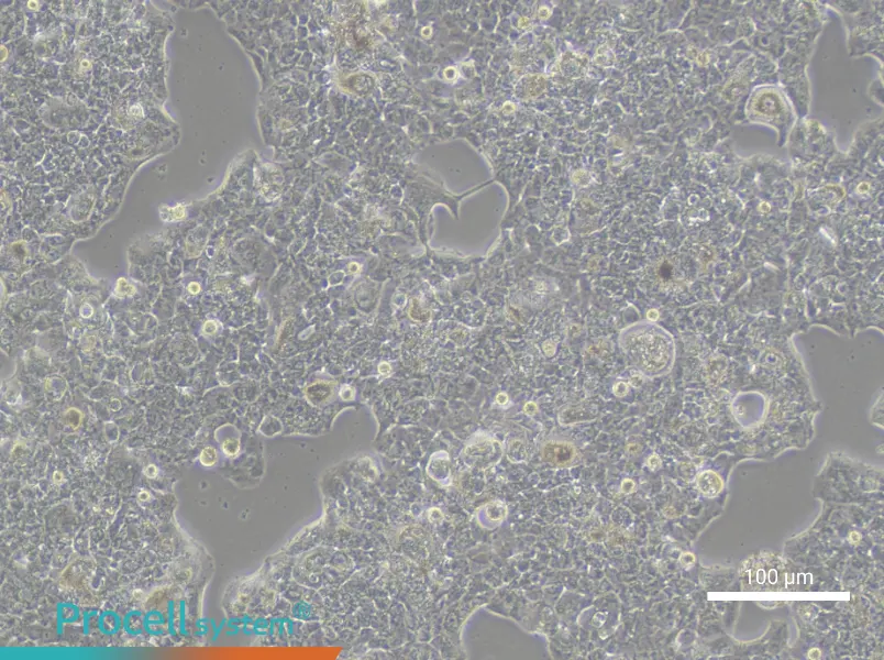 HCC1419 Cell Complete MediumHCC1419 Cell Complete Medium - 2