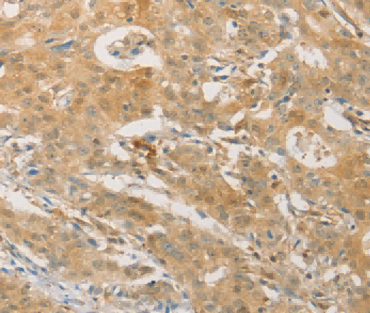 PGK2 Polyclonal Antibody - 2