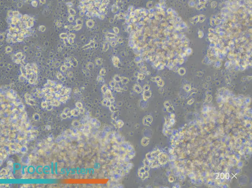 JVM-2 Cell Complete Medium - small - 6