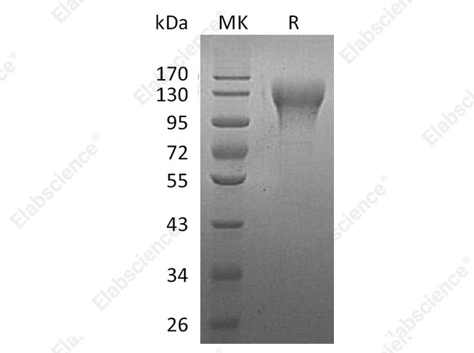 Recombinant Human CD96 Protein (His Tag) - 1
