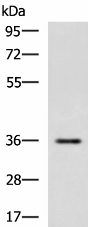 Western blot analysis of Human fetal liver tissue lysate  using IBSP Polyclonal Antibody at dilution of 1:650