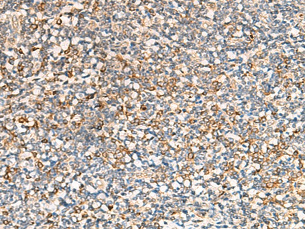 Immunohistochemistry of paraffin-embedded Human tonsil tissue  using SEC22B Polyclonal Antibody at dilution of 1:70(?200)