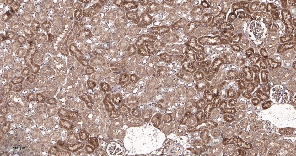 Recombinant Beclin 1 Monoclonal Antibody - 2