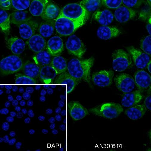 Recombinant PAK3 Monoclonal Antibody - 3