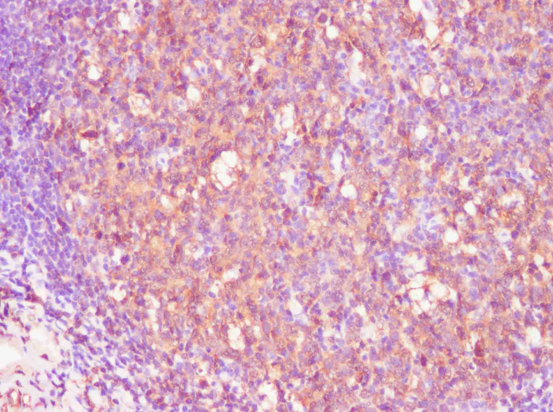 Purified Anti-Human CD45 Antibody[HI30]-1