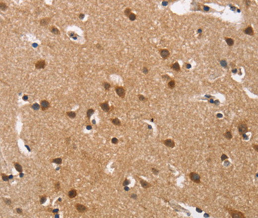 Immunohistochemistry of paraffin-embedded Human brain tissue using Cav1.3 Polyclonal Antibody at dilution 1:40