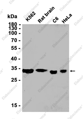 Recombinant ATF5 Monoclonal Antibody - 1