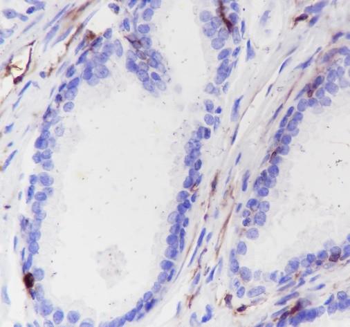 Recombinant Calponin 1 Monoclonal Antibody - small - 3