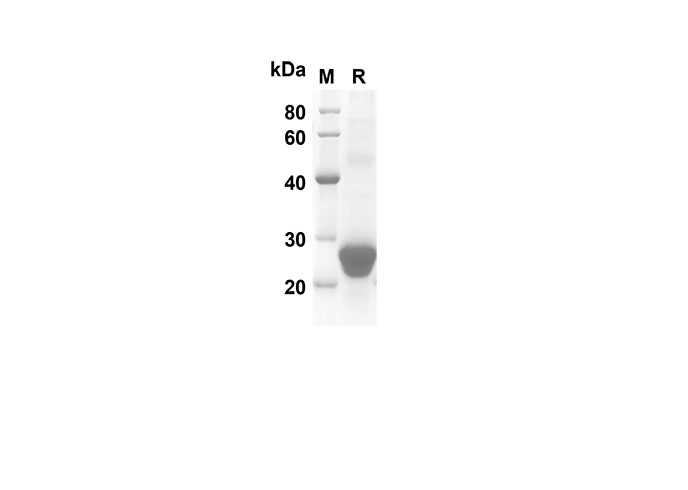 Recombinant Rat CD75/ST6GAL1 Protein (His Tag)-产品推荐-1