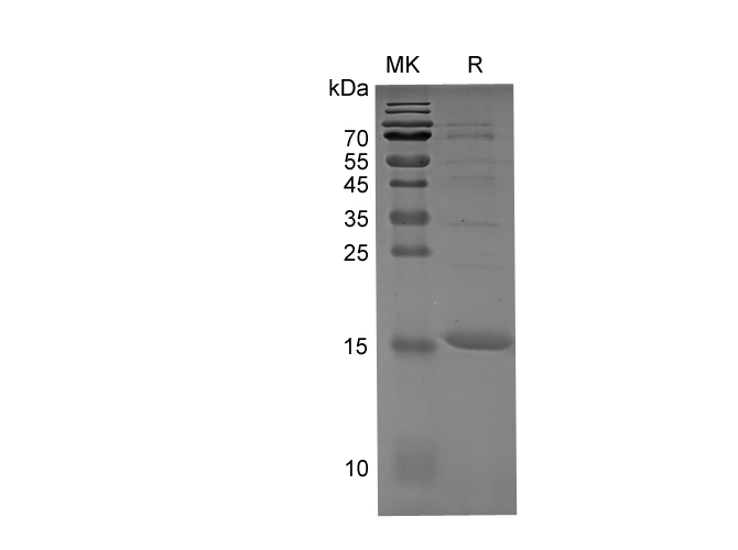 Recombinant Mouse IL-10 Protein(His Tag)-产品推荐-1