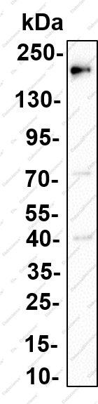 Recombinant EGFR (Phospho Tyr845) Monoclonal Antibody - 1