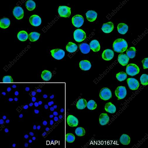 Recombinant Thymidylate Synthase Monoclonal Antibody - 4