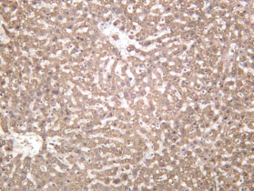Recombinant METTL16 Monoclonal Antibody - 3