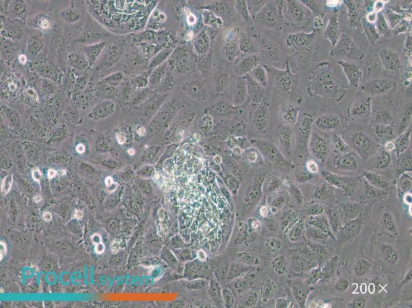 TR-LCC-1 Cell Complete Medium - 5