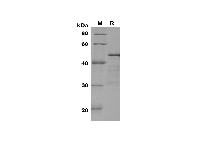 Recombinant Rat IL7R/IL-7R/CD127 Protein(His Tag)-产品推荐-1