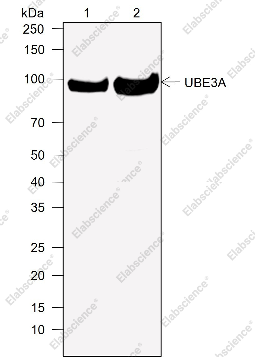 Recombinant UBE3A Monoclonal Antibody - 1
