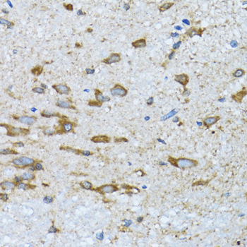 Immunohistochemistry of paraffin-embedded Mouse spinal cord using PDP1 Polyclonal Antibody at dilution of  1:100 (40x lens).