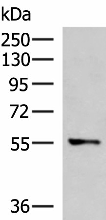 Western blot analysis of A172 cell lysate  using TEKT5 Polyclonal Antibody at dilution of 1:800